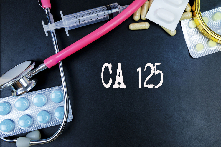 בדיקת CA-125 - תמונה